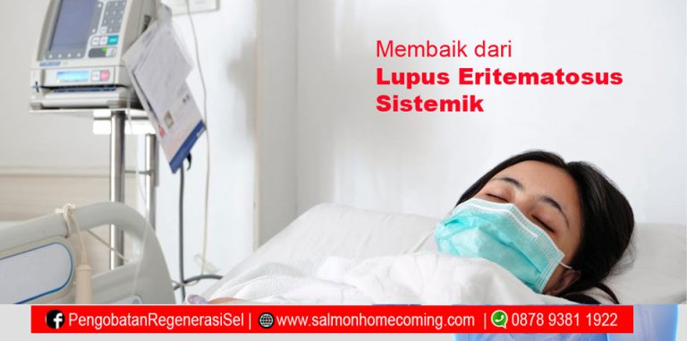 Systemic Lupus Erythematosus Tandatanda Obat Dll  Hello Sehat