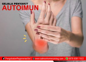 Obat Herbal Buat Autoimun S Lutena Indonesia