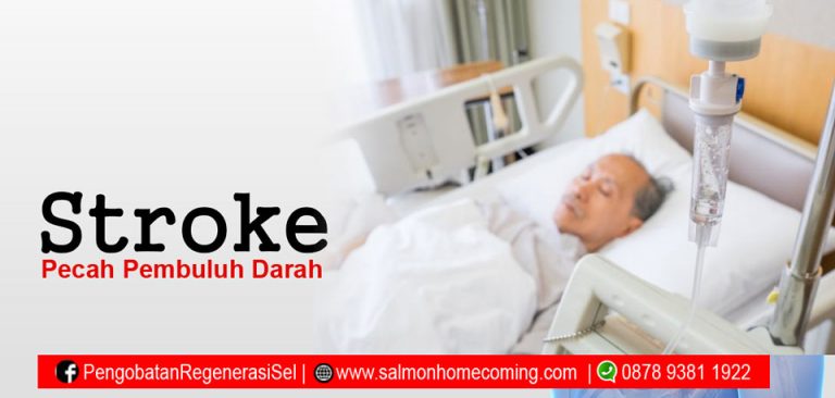 Stroke Pecah Pembuluh Darah Membaik Apakah Bisa Sembuh Total